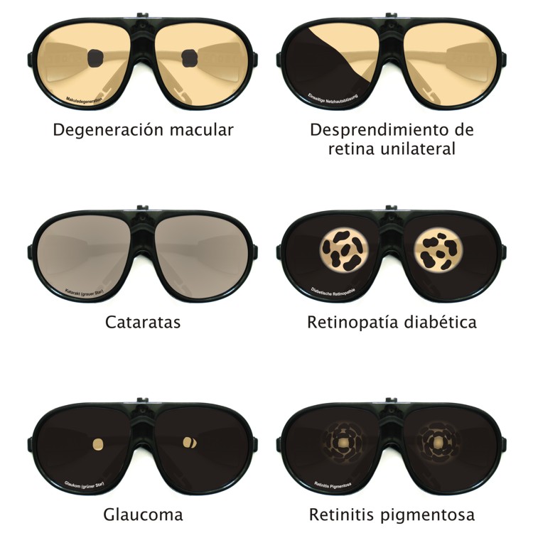 Simulación de deficiencias visuales